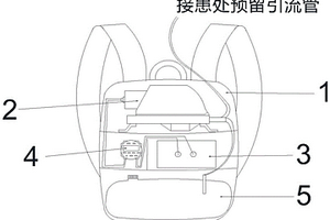 定時自動抽取患處組織積液裝置